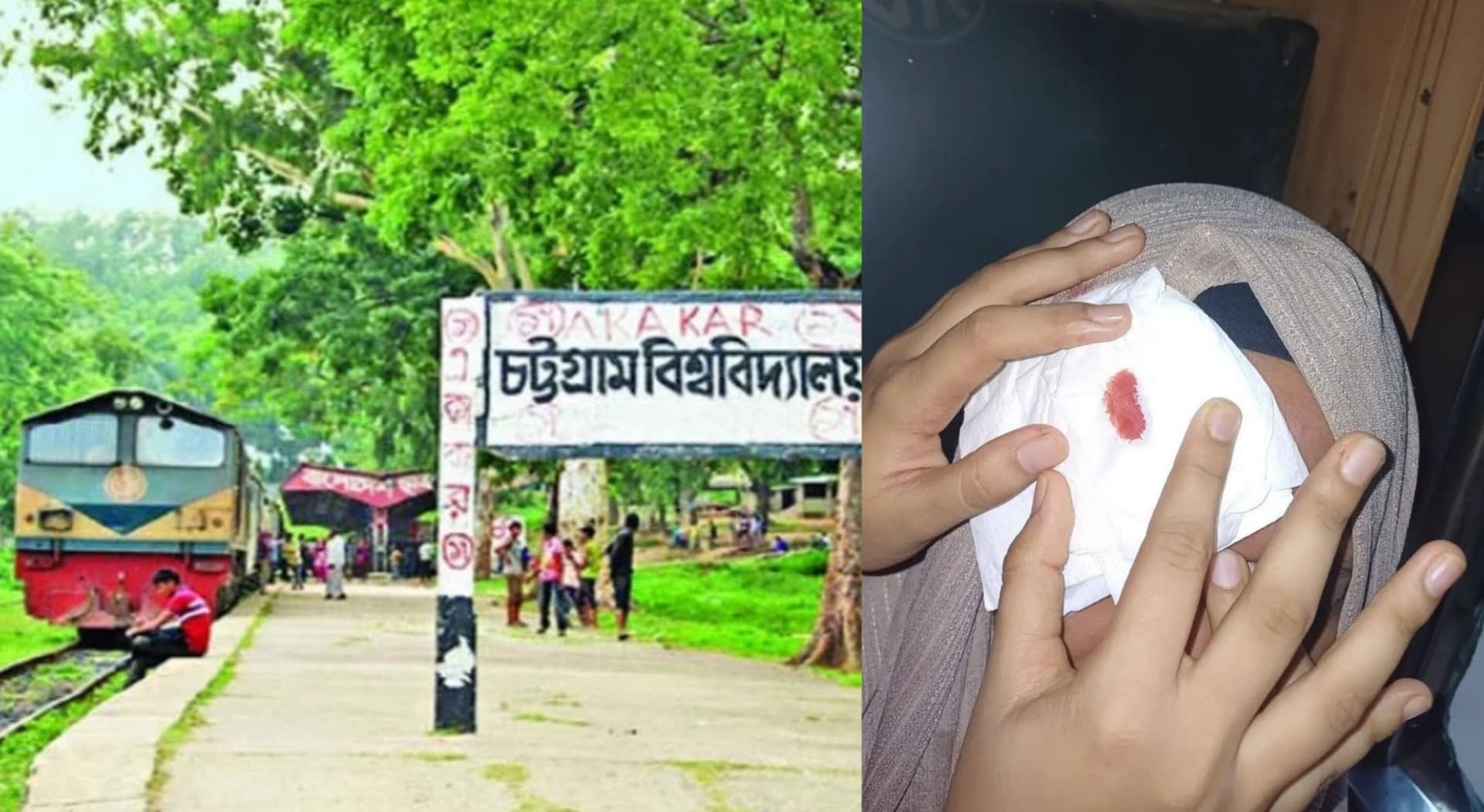 চবির শাটলে পাথর নিক্ষেপ, আহত হয়ে অজ্ঞান ছাত্রী- খবরের থাম্বনেইল ফটো