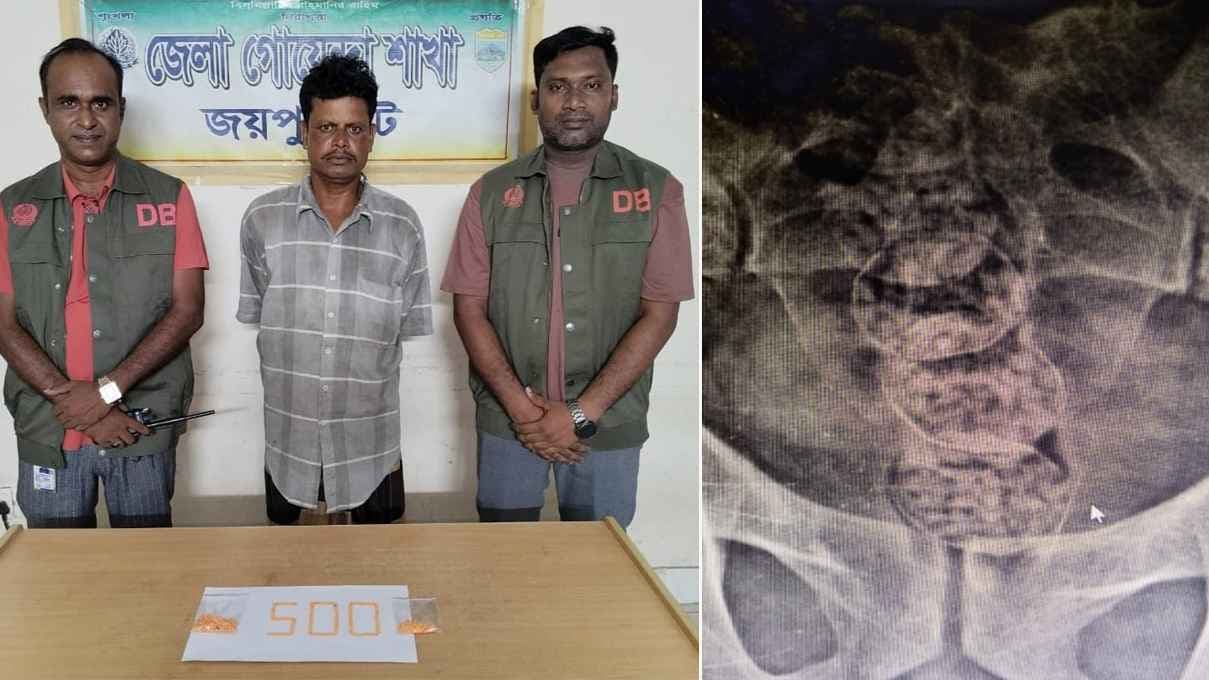 পেটের ভেতরে ৫০০ পিস ইয়াবা, কারবারি গ্রেফতার- খবরের ইমেজ Image