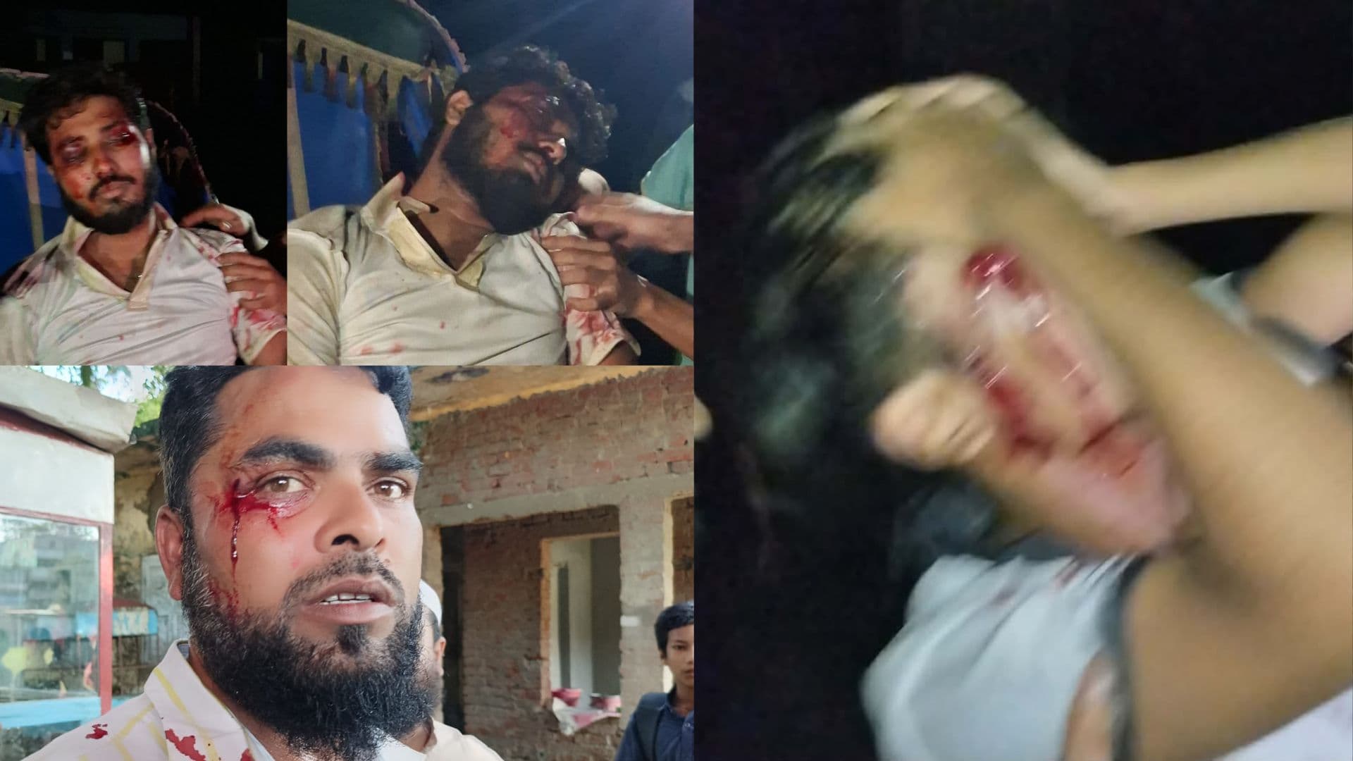 চেয়ারে বসা নিয়ে রাবির দুই বিভাগের শিক্ষার্থীদের দফায় দফায় সংঘর্ষ, আহত ৪- খবরের থাম্বনেইল ফটো