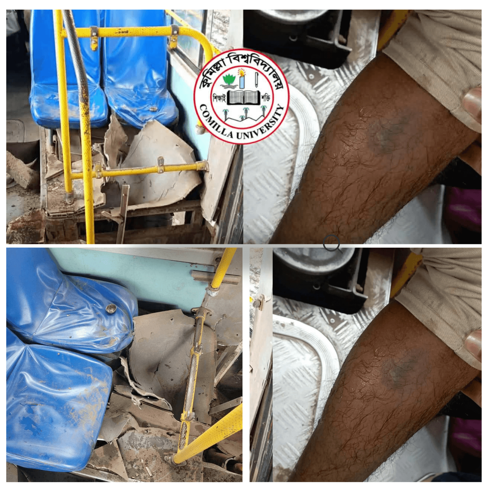 কুবি বিআরটিসি বাসের চাকা বিস্ফোরণ, শিক্ষার্থী আহত- খবরের ইমেজ Image